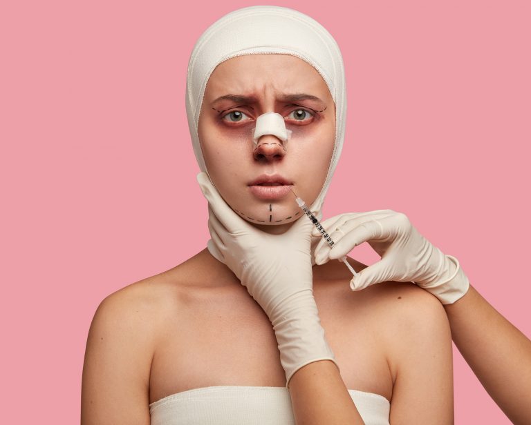 Cosmetic surgery mishaps, mistakes and malpractice. medical negligence
