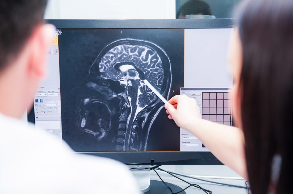 Doctors magnetic resonance image (MRI) injured brain, head injury compensation claim solicitors Bristol